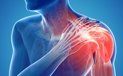 Causes and Treatment for Pinched Nerves in Shoulder | Crist Chiropractic